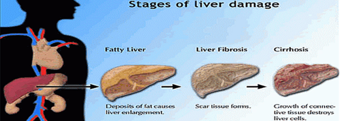 liver